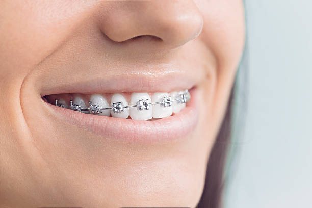 Best Veneers and Lumineers  in New Roads, LA